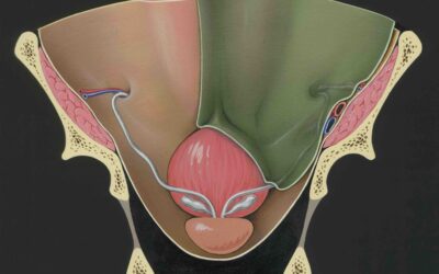 Cancro della prostata. 40 mila casi solo nel 2024